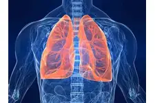 Aort Anevrizması Ameliyatı Sonrası Komplikasyonlar Aort Anevrizması Ameliyatı Sonrası Komplikasyonlar