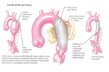Arkus Aorta Bölümleri Arkus Aorta Bölümleri